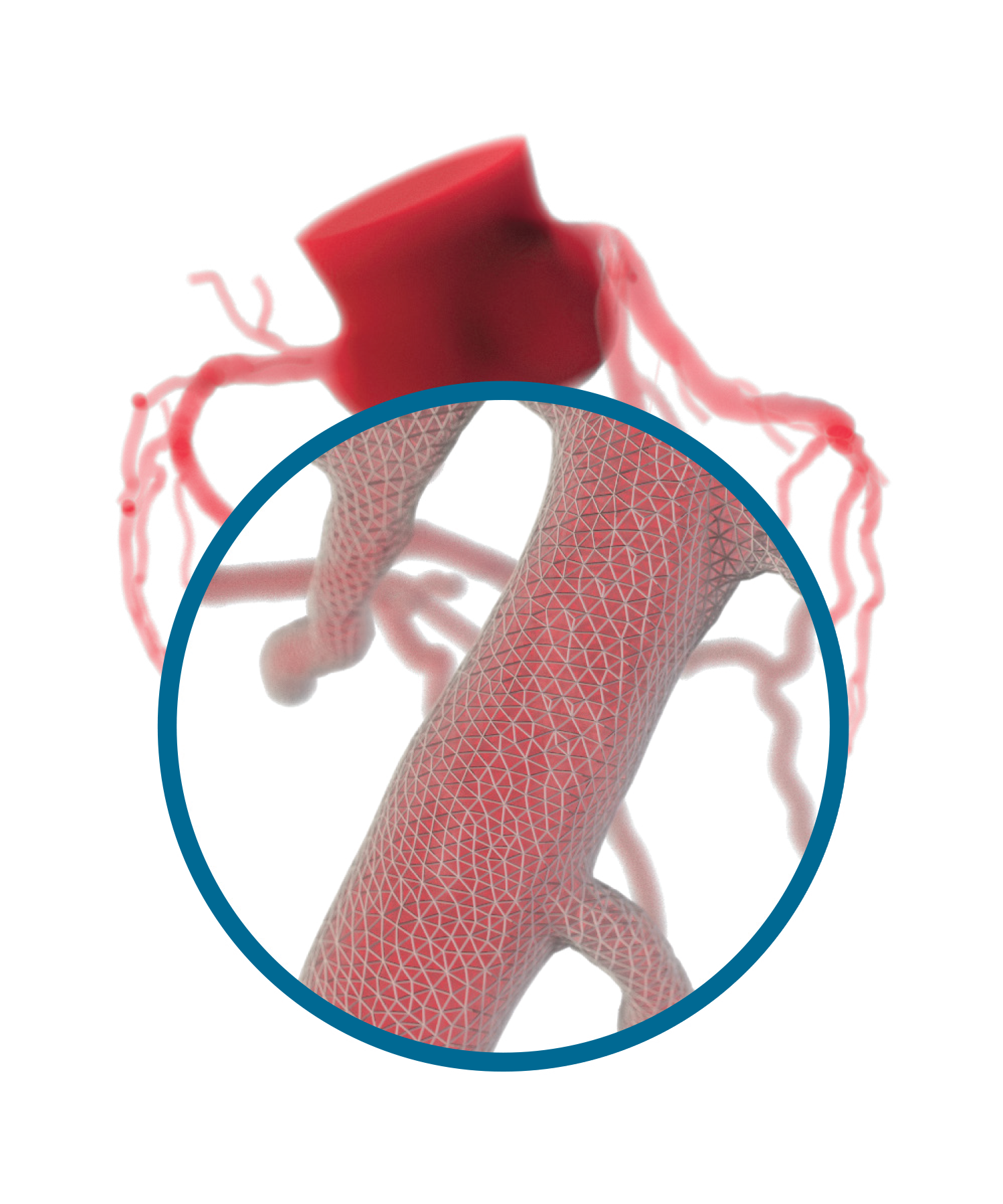 HeartFlow-3D Physiologic Assessment