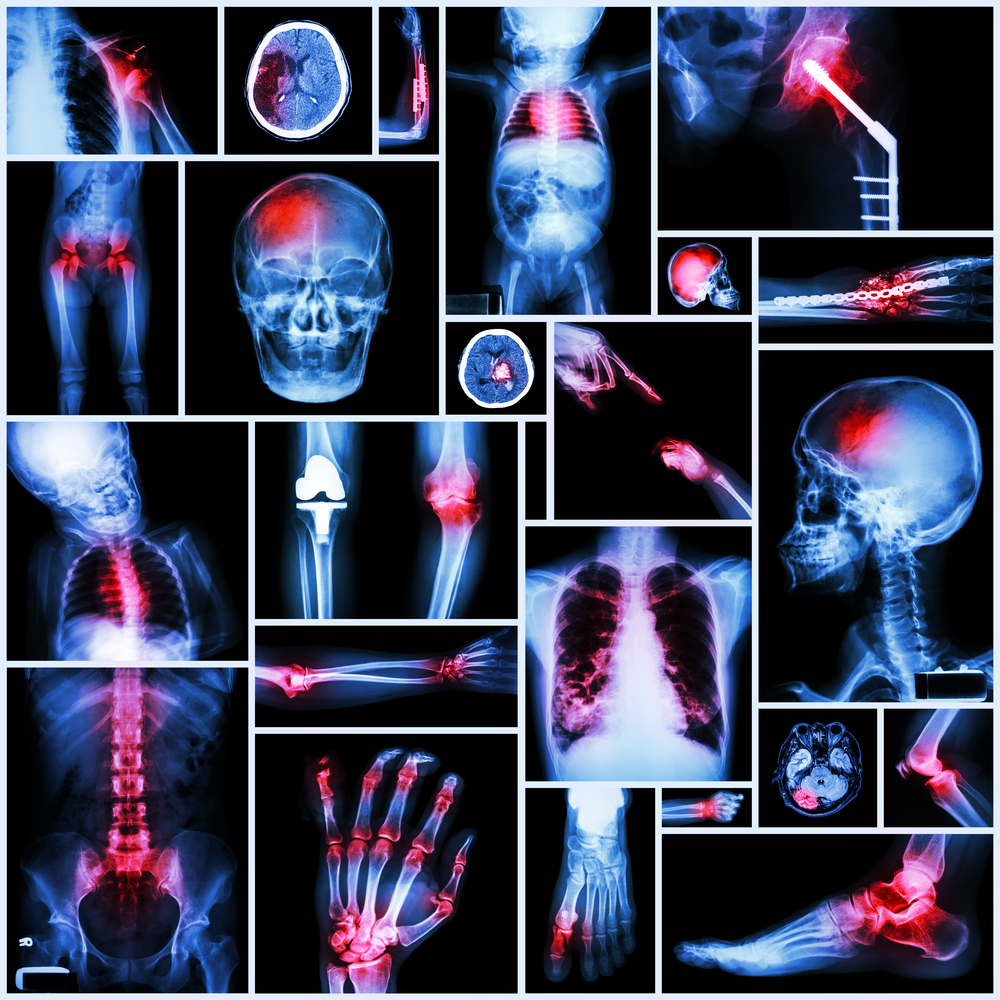 Diagnostic imaging